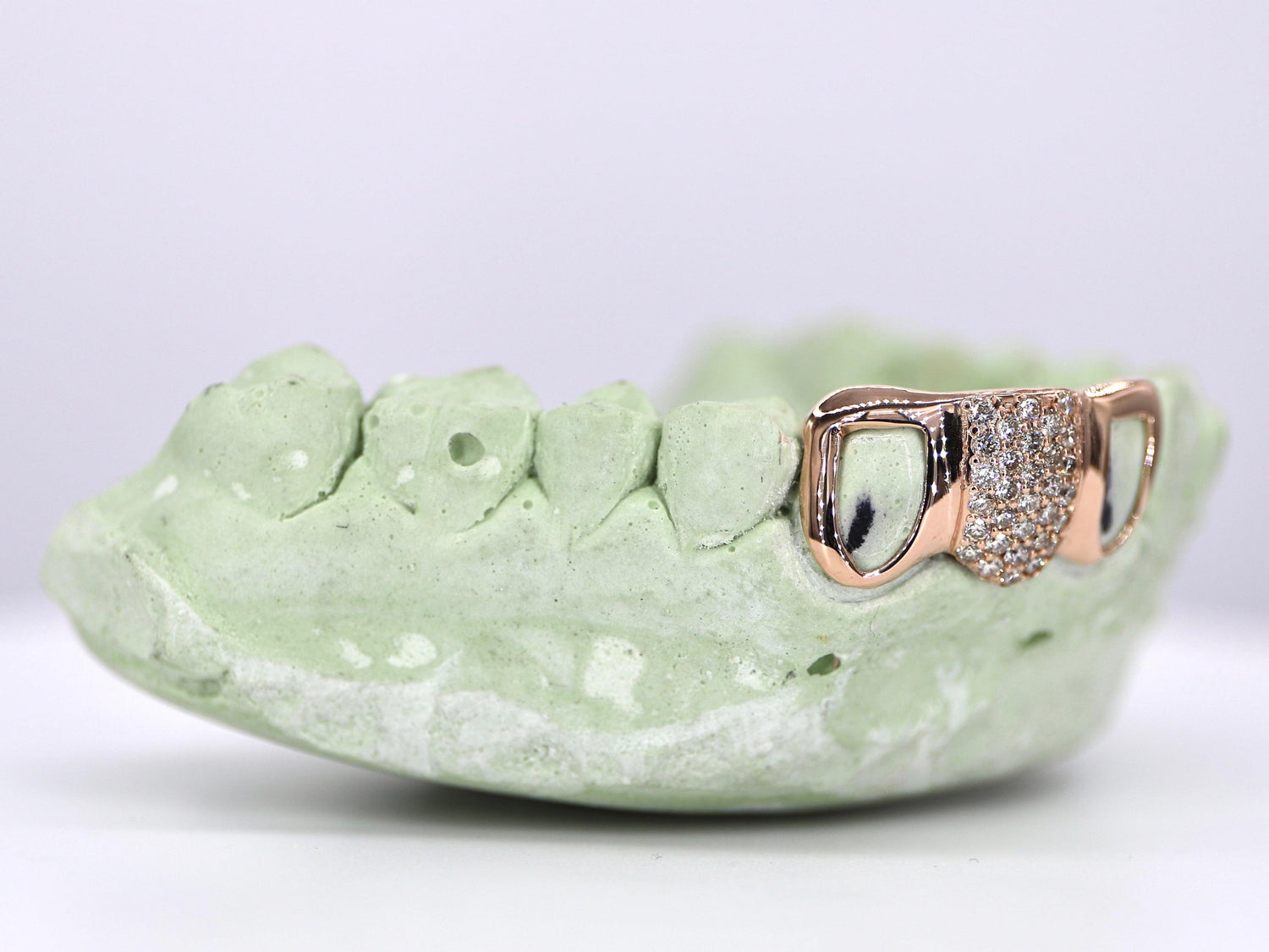 MOISSANITE GRILLZ