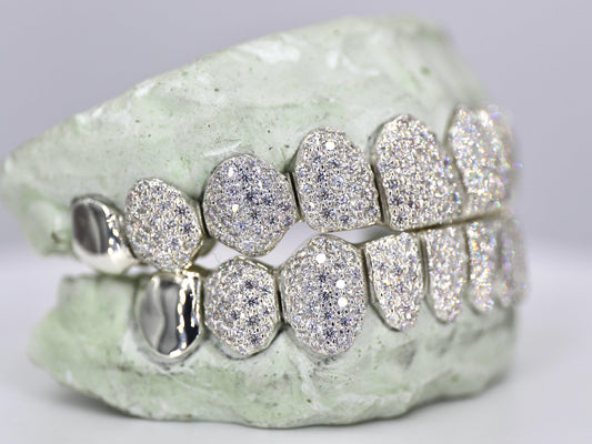 10 on 10 Capped VVS Moisannite Diamond Grillz