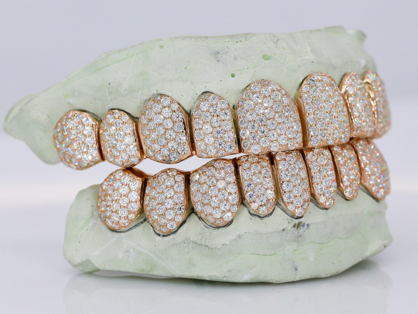 10 on 10 VVS Moisannite Diamond Grillz