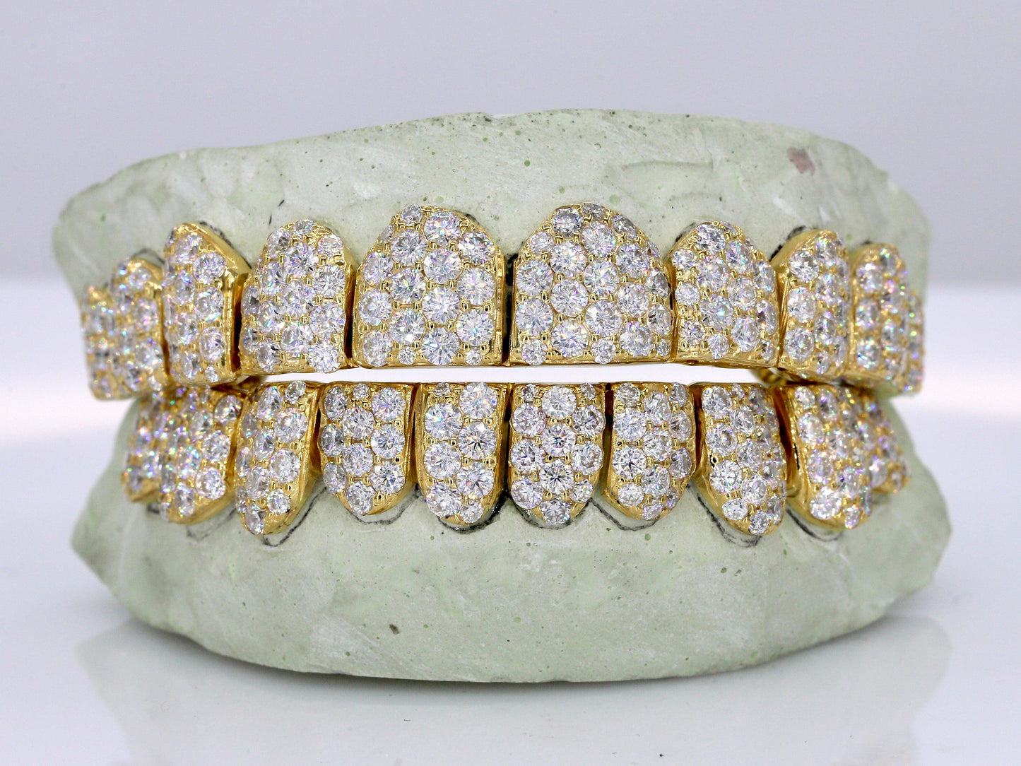 Jumbo VVS Moissanite Diamond Grillz