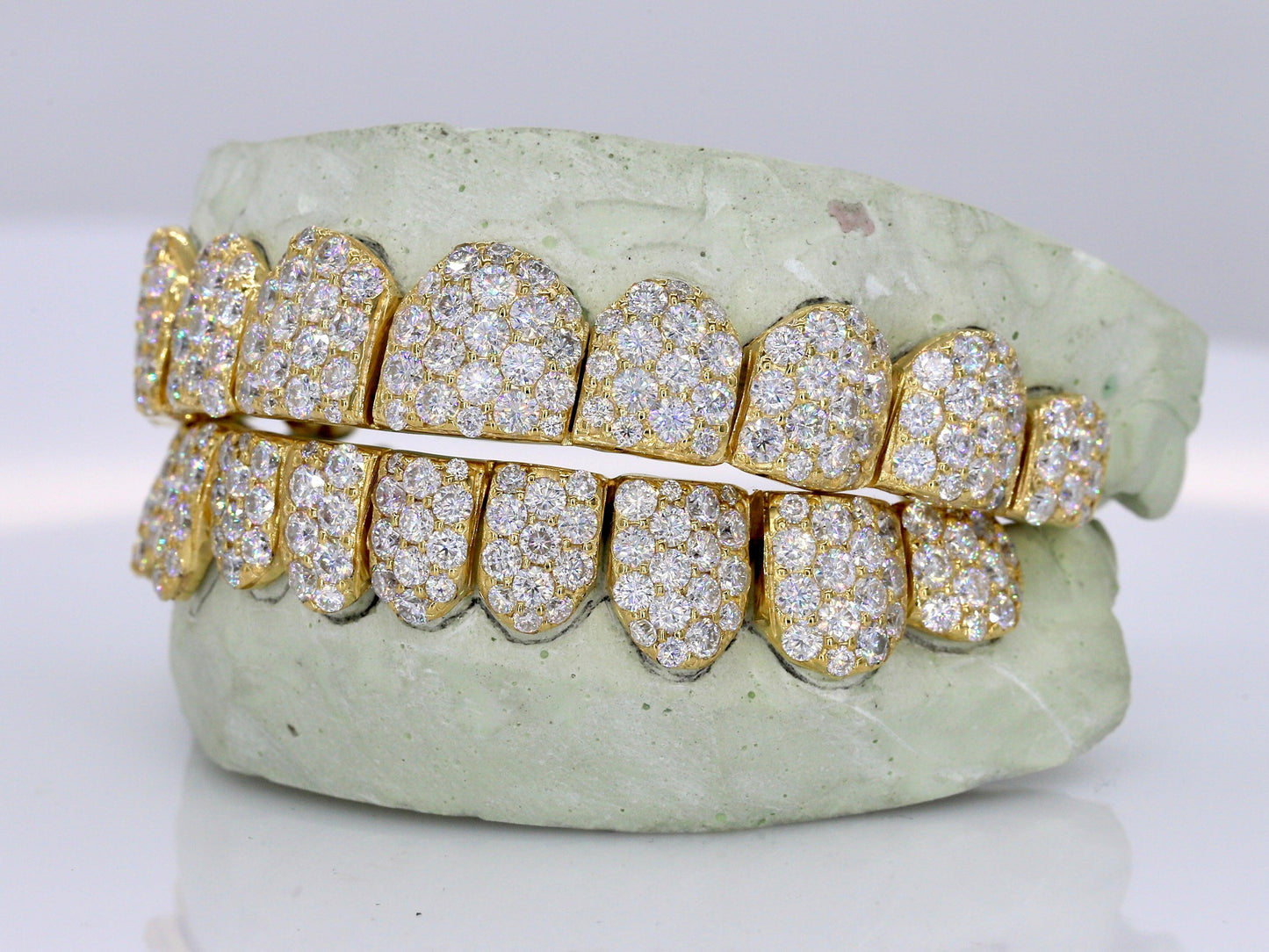 Jumbo VVS Moissanite Diamond Grillz