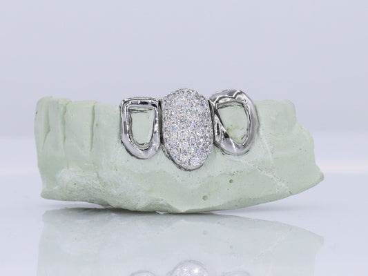 1 Tooth Diamond & 2 Teeth Open Faced VVS Moissanite Diamond Grillz