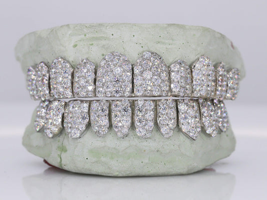 Jumbo VVS Moissanite Diamond Grillz