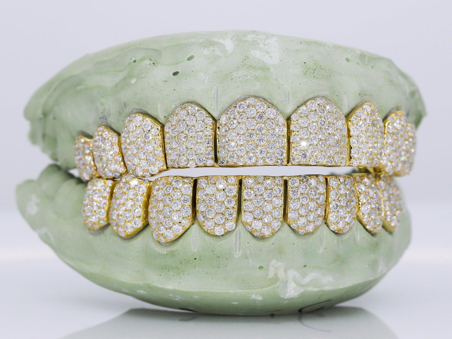 10 on 10 VVS Moisannite Diamond Grillz