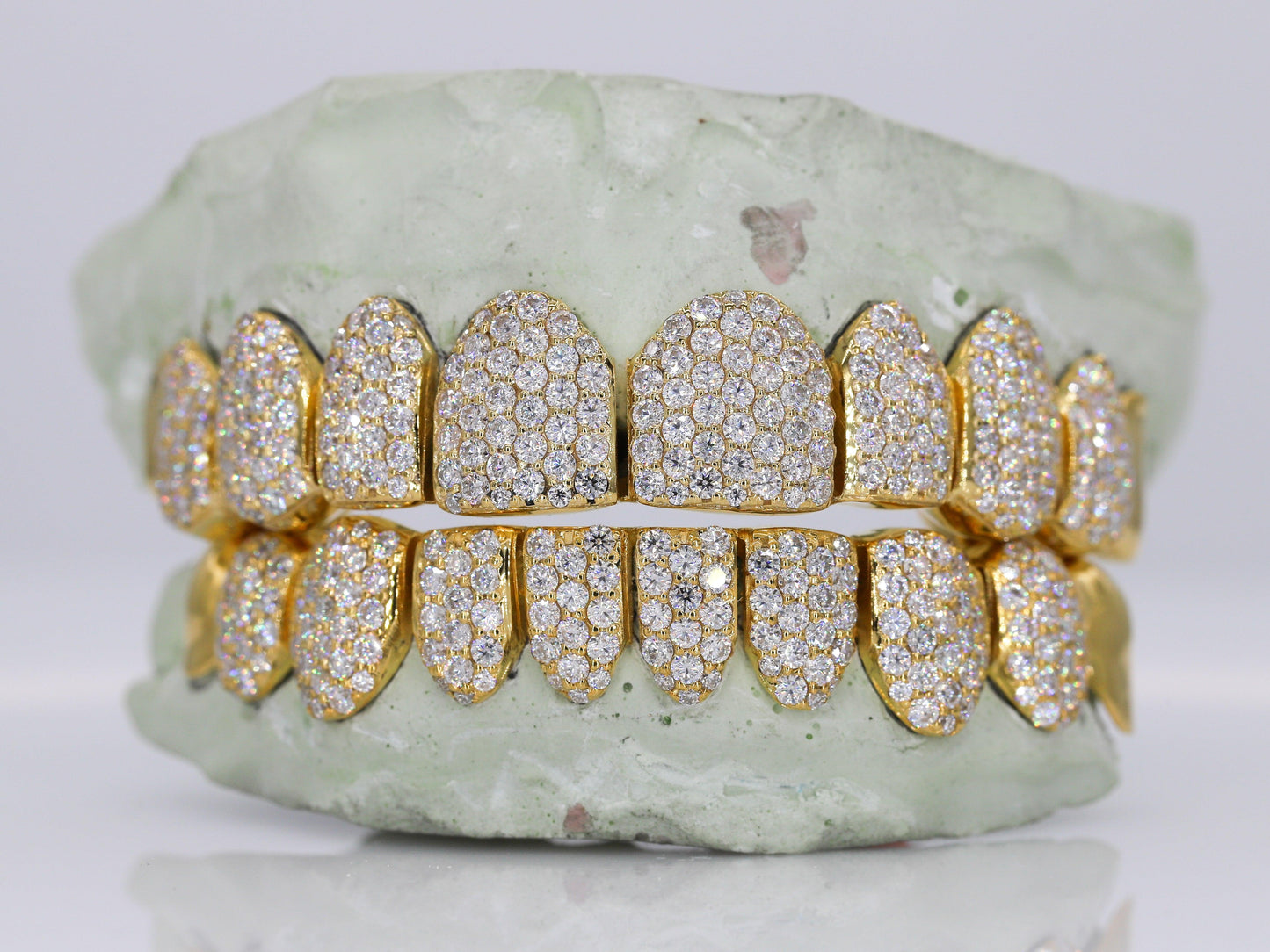 10 on 10 Capped VVS Moisannite Diamond Grillz