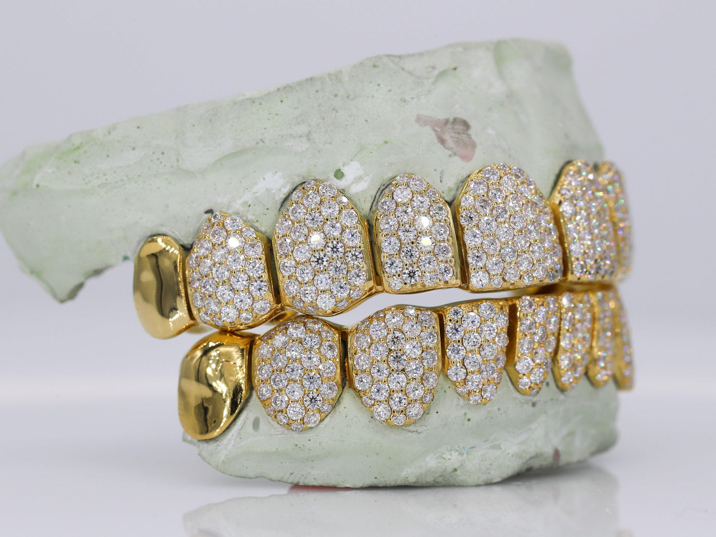 10 on 10 Capped VVS Moisannite Diamond Grillz