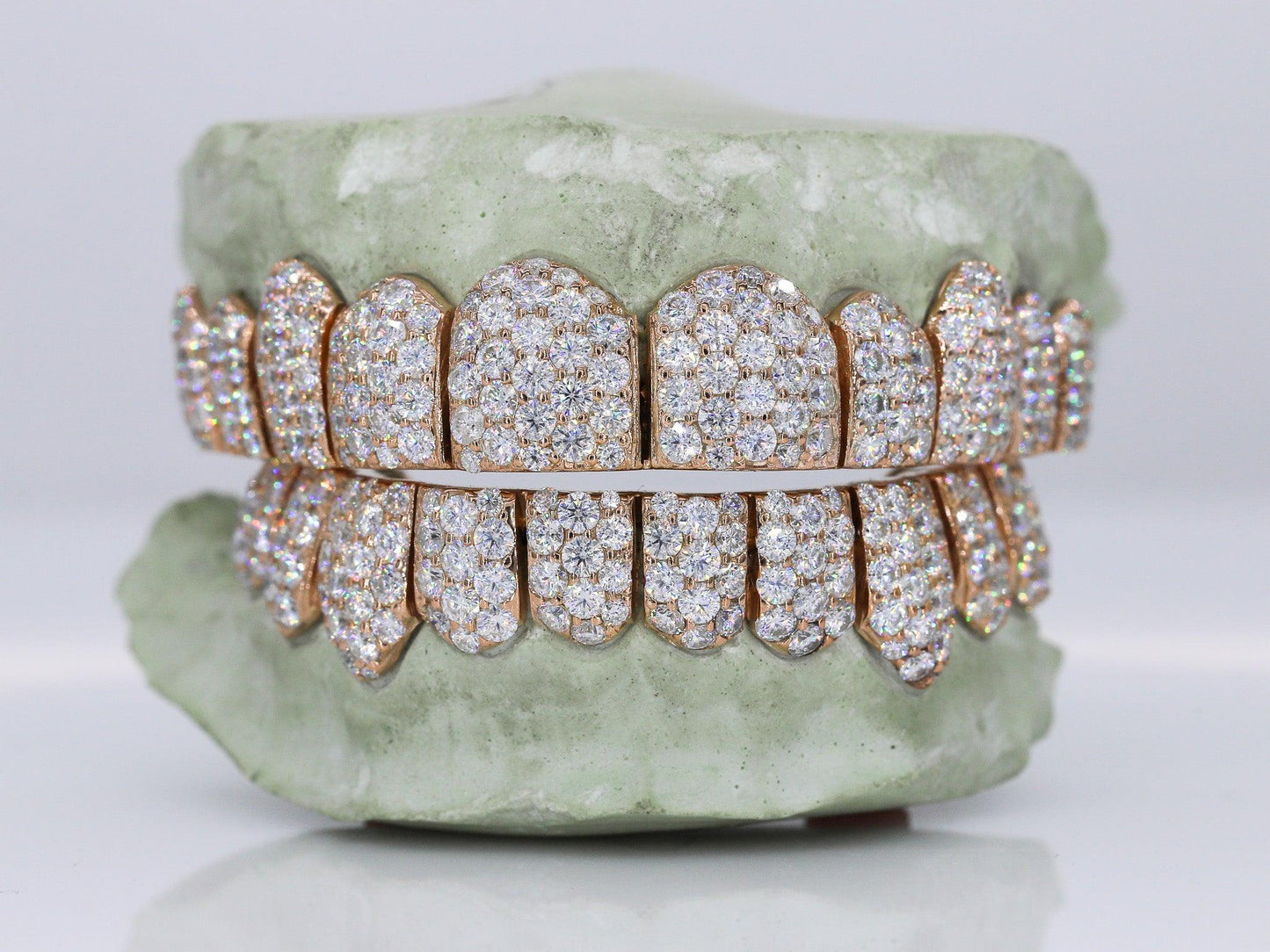 Jumbo VVS Moissanite Diamond Grillz