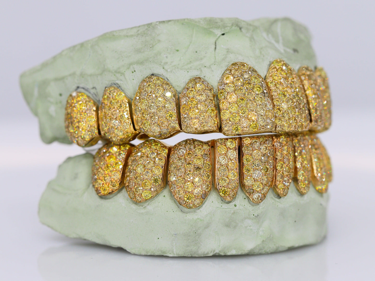 Canary Yellow VVS Moissanite Diamond Grillz