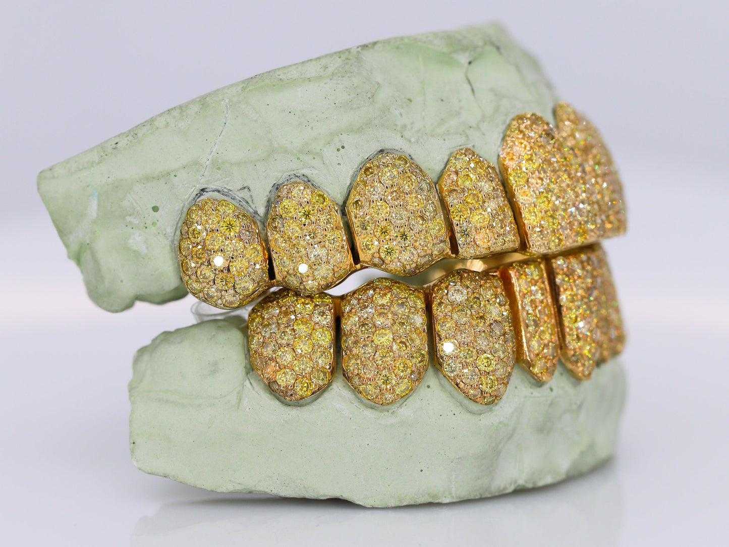 Canary Yellow VVS Moissanite Diamond Grillz