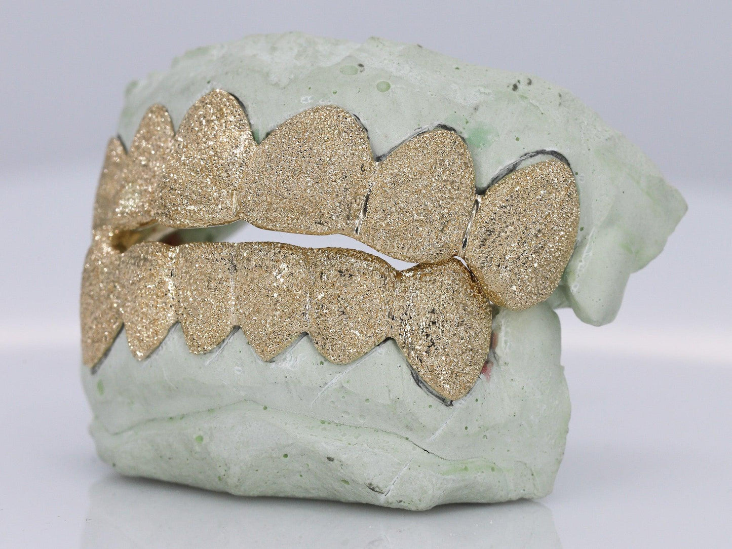 Diamond Dust Grillz