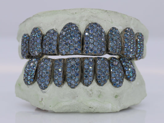 Ice Blue VVS Moissanite Diamond Grillz