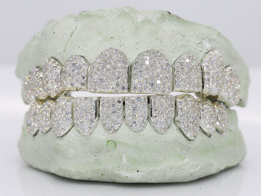 VVS Lab Diamond Grillz