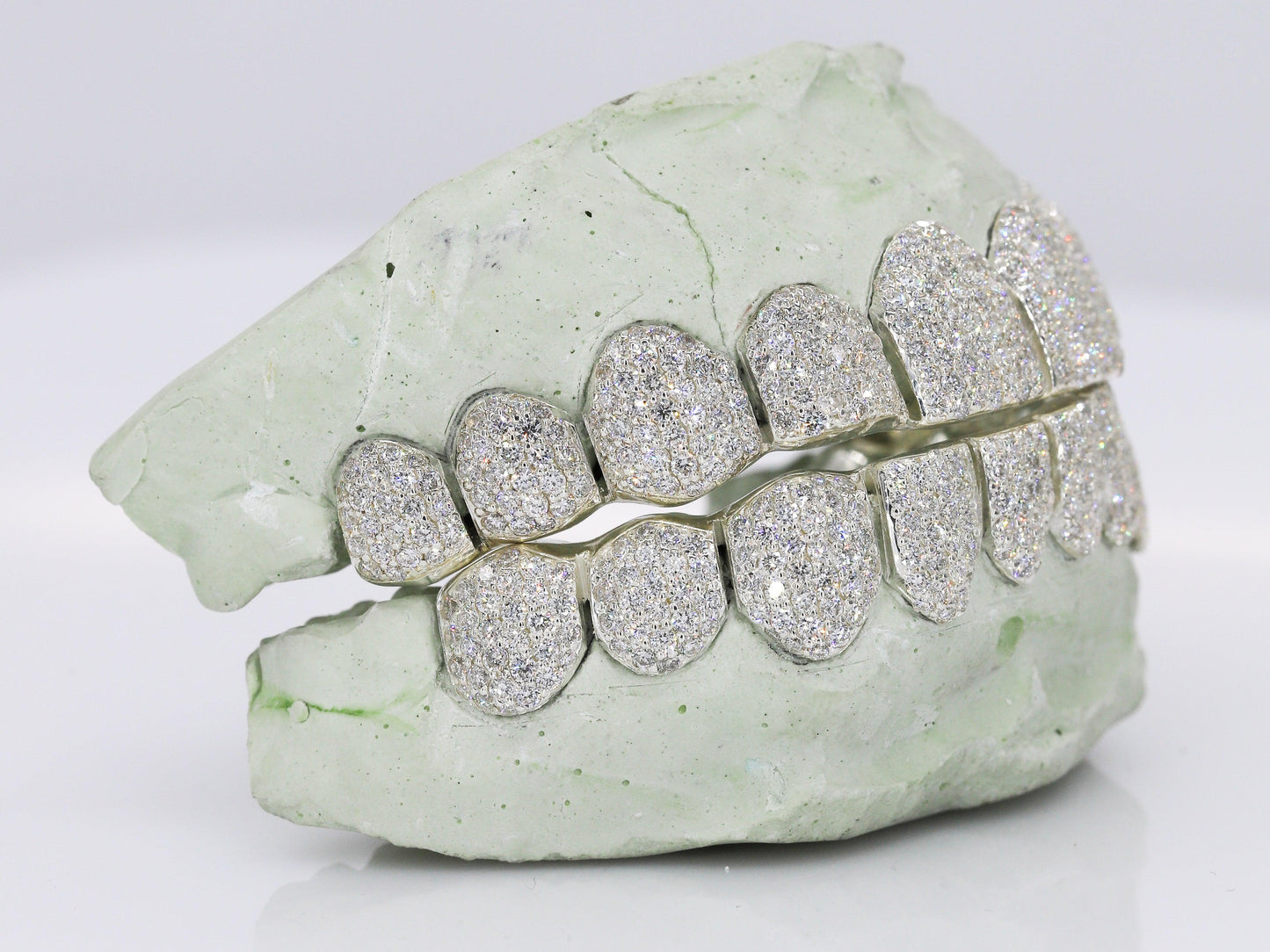 VVS Lab Diamond Grillz