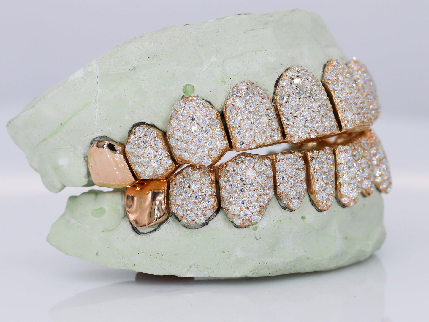 10 on 10 Capped VVS Moisannite Diamond Grillz