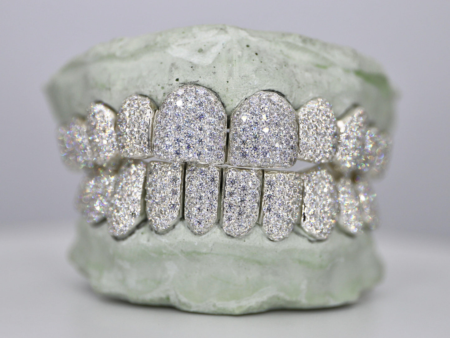 Customizable VVS Moissanite Diamond Grillz