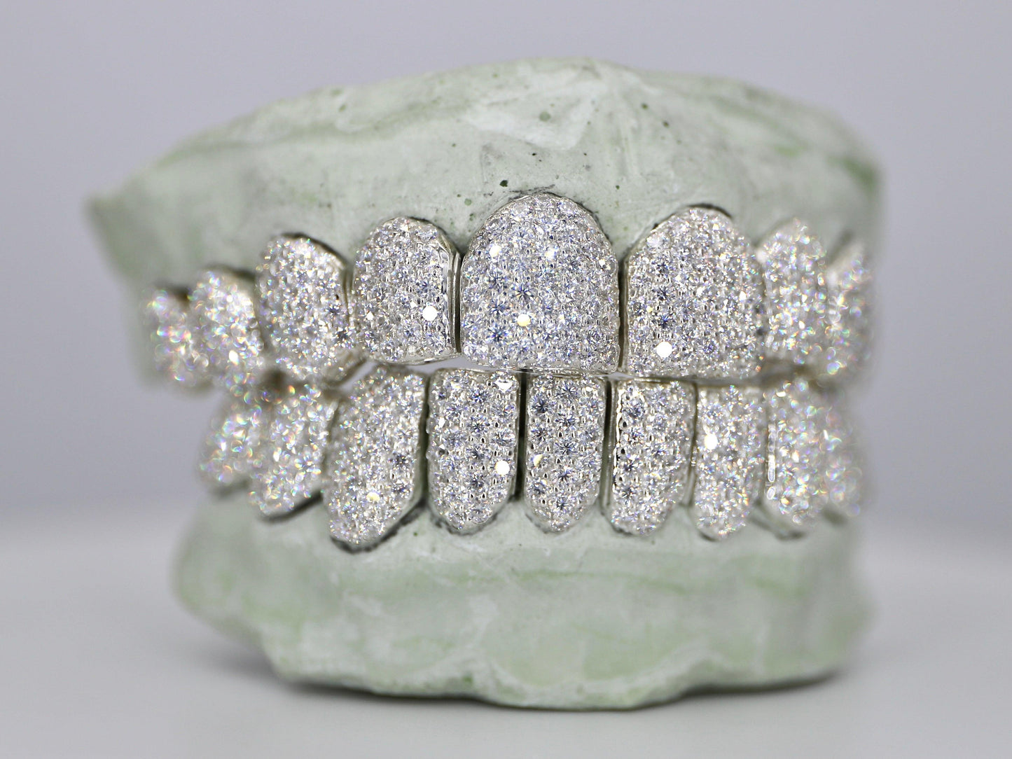 Customizable VVS Moissanite Diamond Grillz