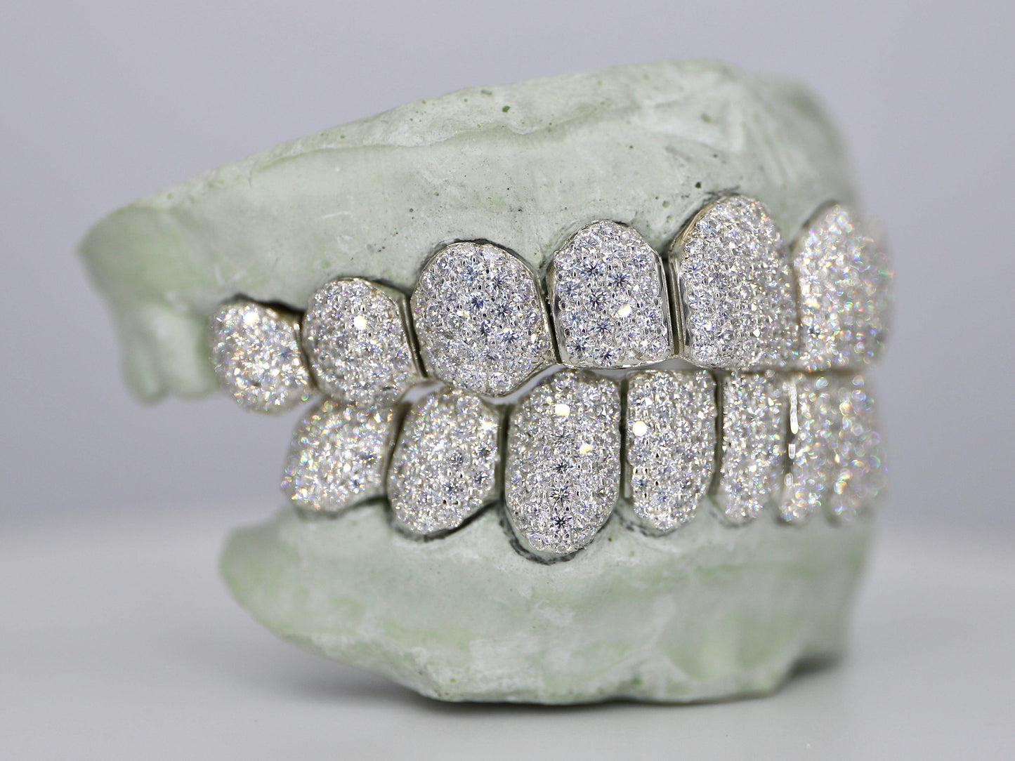 Customizable VVS Moissanite Diamond Grillz