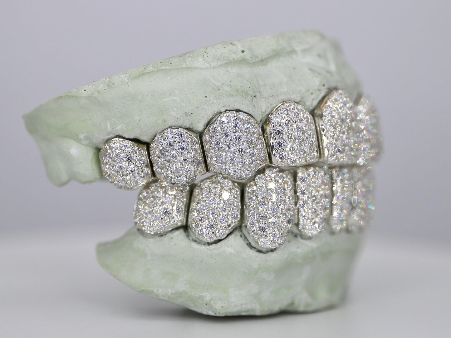 Customizable VVS Moissanite Diamond Grillz